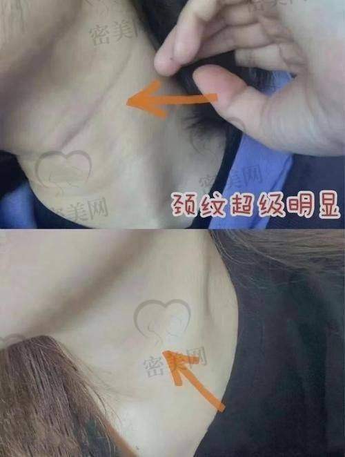 见效时间有差？你要的“速度与激情”来了！