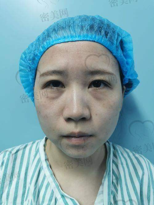 广州健丽医美如何预约？线上线下都特别方便！