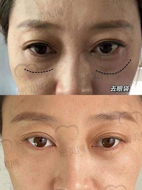 广州健丽医美坐诊医生信息一览，看看哪个适合你