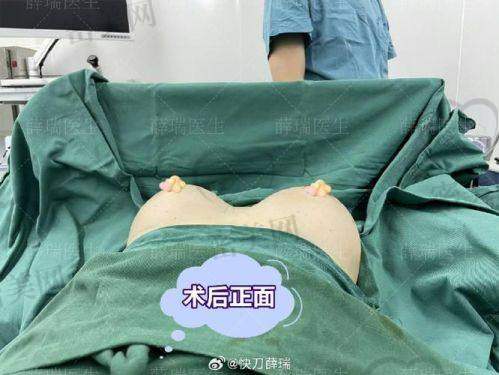 德国宝俪、水滴高端假体套餐信息也完全不藏