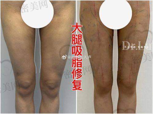 重庆当代整形外科医院姜北：实力医生的魅力所在