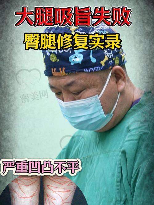 重庆当代整形外科医院黄鲜吸脂：30000 元起的梦幻价格