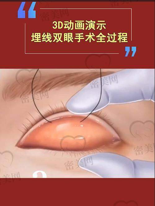 韩勋眼部项目价格参考（部分修复类含价格区间）