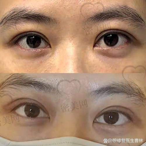 重庆艺星医疗美容医院亓麟：20000 元起背后的医生魅力