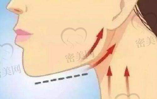 韩美整形医院口碑表现如何？真实实例反馈，服务温度让顾客归属感满满