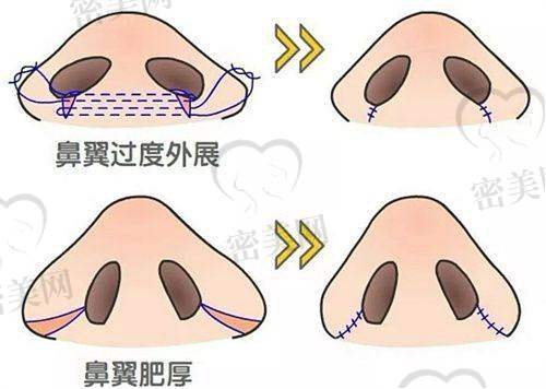 惠州觅妍医疗美容门诊部