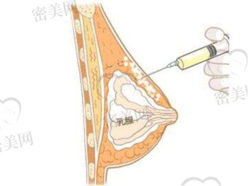 拉萨爱思特在地医美影响力及口碑表现