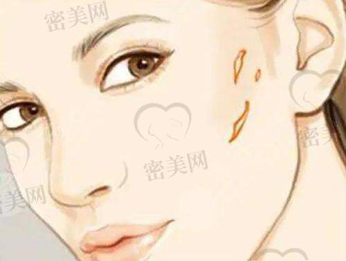西安健丽医美
