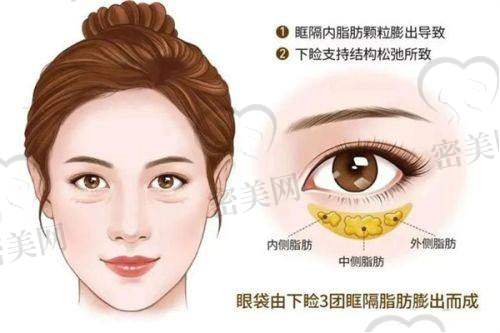 术前术后对比亮眼，真实反馈来自本地求美者