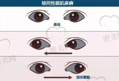 赣州爱尔眼科半飞秒系列手术费用详情