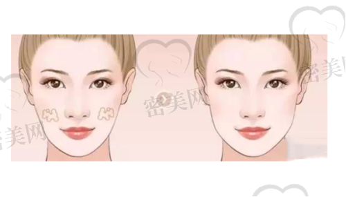 西安画美医疗美容：韩国技术认证，鼻眼整形亮眼