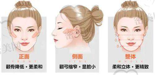 西安画美医院环境如何？女性私密诊疗是否重视隐私？