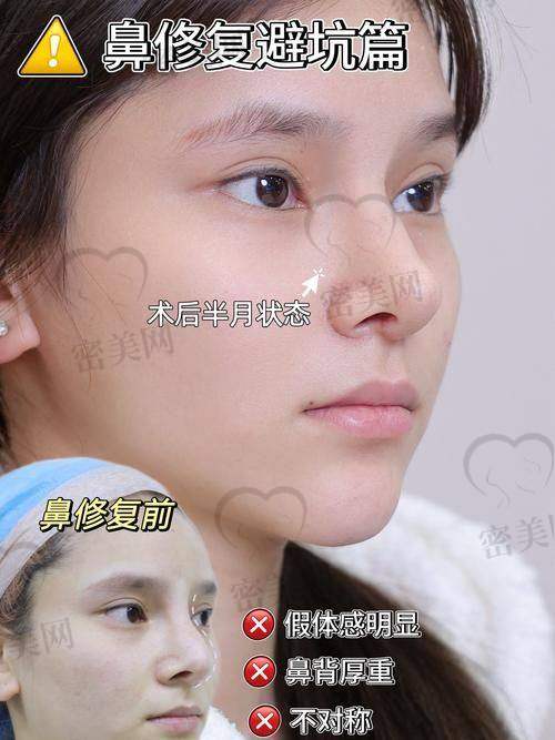 合肥壹加壹整形医院：全方面分区的蒙特鼻美学