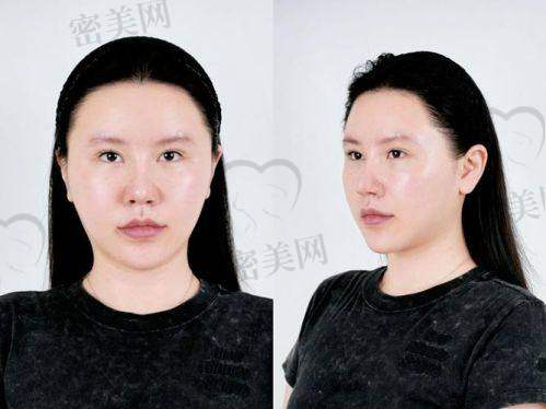 重庆松山医院：75800 元背后的“变得更美后盾”