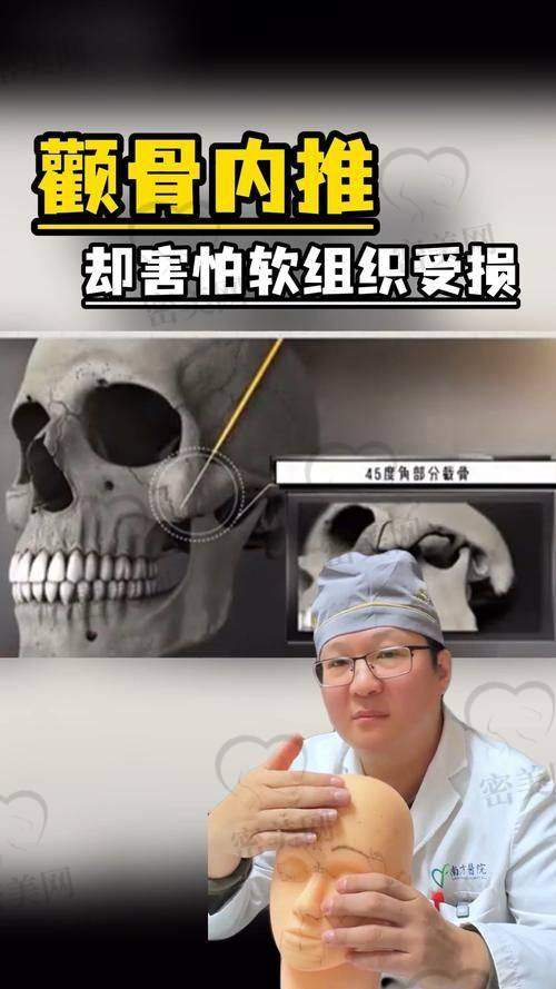 重庆松山医院王涛颧骨颧弓整形：75800 元背后的技术魔法