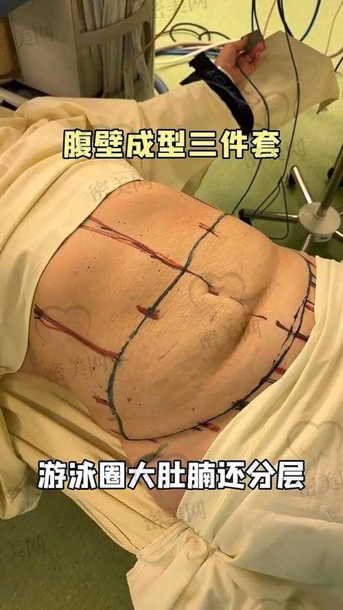 做完就后悔？那是你没选对需求匹配方案
