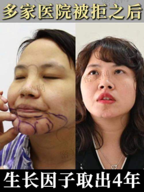 如何选择合适的医院和医生