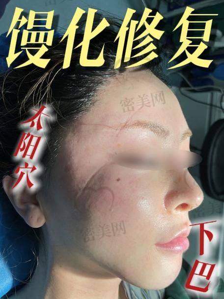 术后护理的重要性