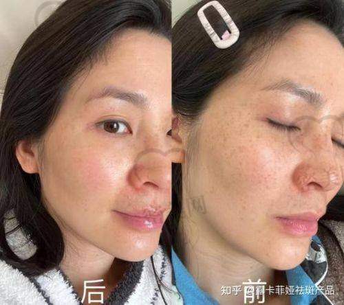 西 京医院治疗流程规范，疗前评估+术后护理一步到位