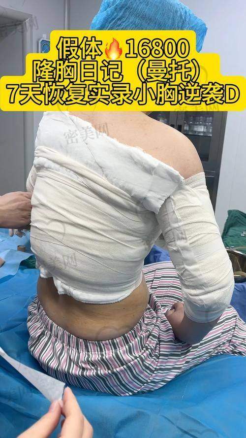 重庆当代整形外科医院周璐珩：20000 起的假体隆胸，性价比之王！
