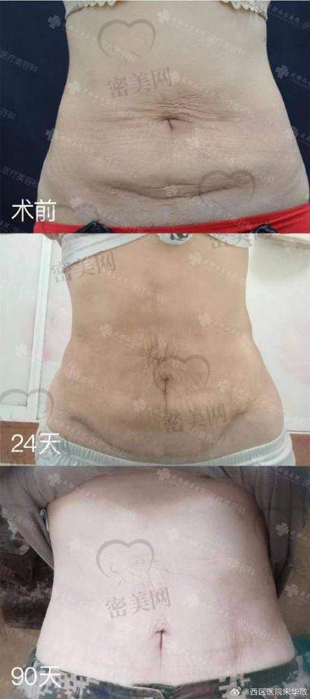 那些“术后太美啦”的实例里，他们做了哪些功课？