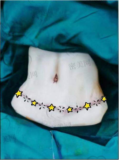 怕疼怕疤？你得了解修复过程的真相
