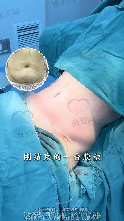 术后成效到底“值不值”？数据和镜子说话