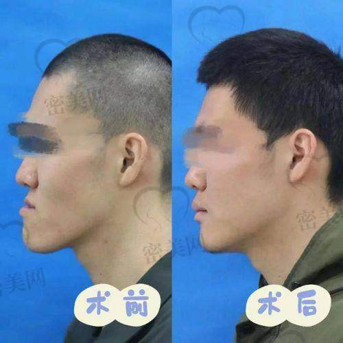 3. 下巴能不能“收回来”？试试看就知道