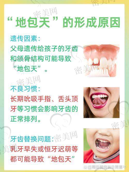 一、地包天的“轻”与“重”，关键看这几个方面