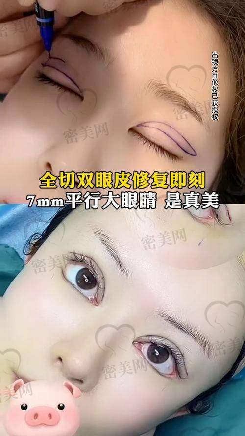 龚卫华医生技术特点：