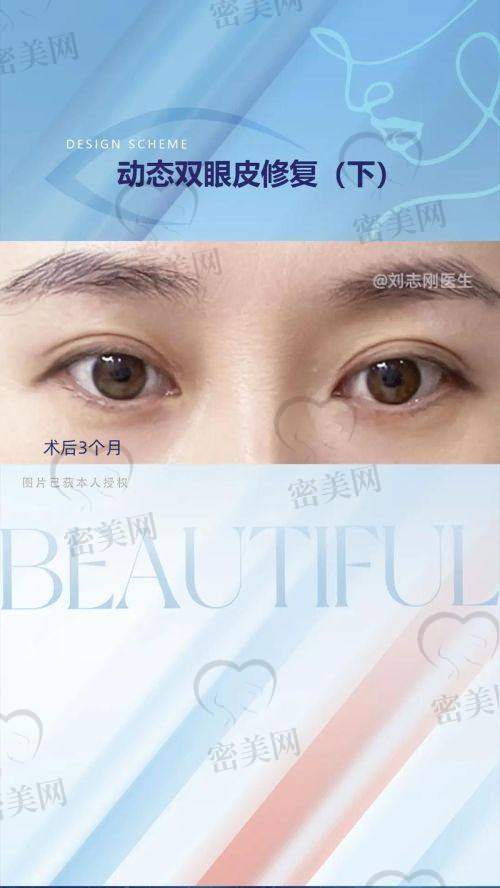 重庆华美紫馨整形医院：美眼项目的“坚强后盾”