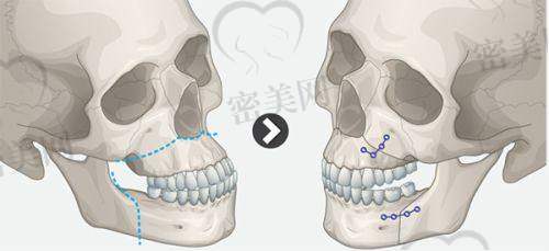 广州焕美医疗美容：数字导航，年轻人优选