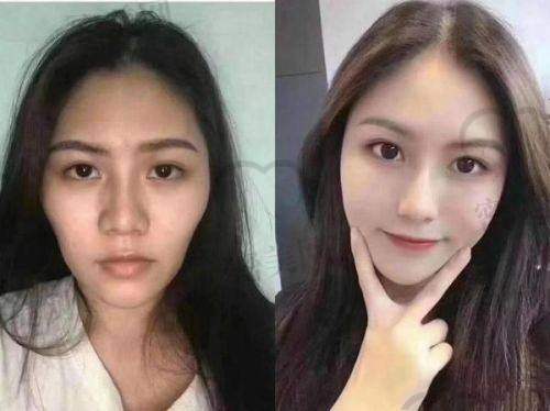 郑州华熙医疗美容