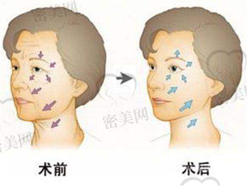 南京兰桂坊医疗美容诊所