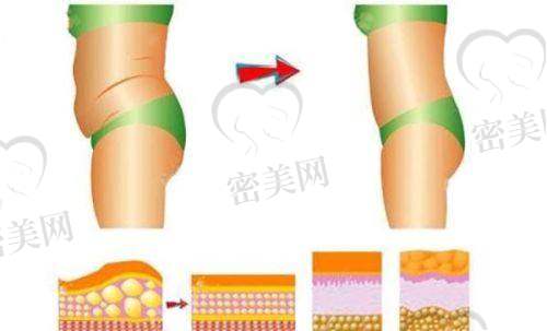 西安高新医院医疗美容科特色项目：