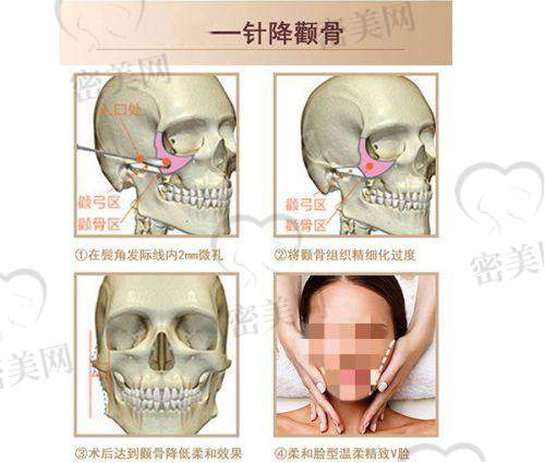 大连雅婷医疗美容医生团队怎么样?专精靠不靠谱?