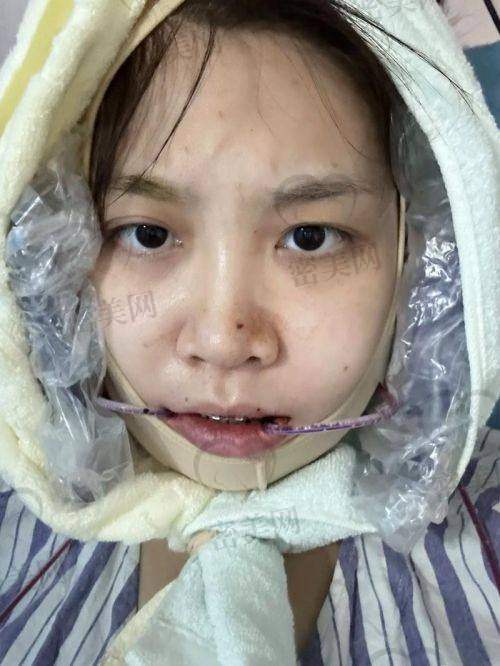 重庆松山医院肖林正颌的技术优势大揭秘