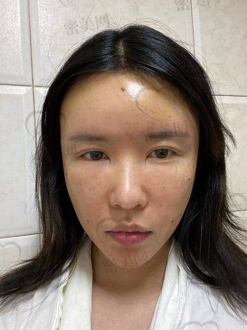 郑州美莱医疗美容
