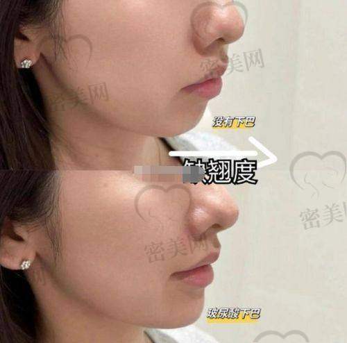 医美机构活动