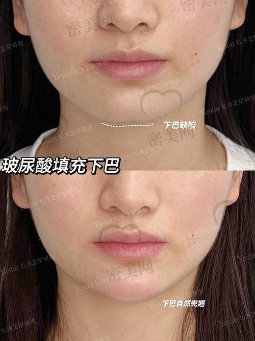 选择合适的医院和医生