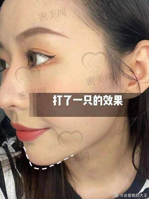 医美产品价格