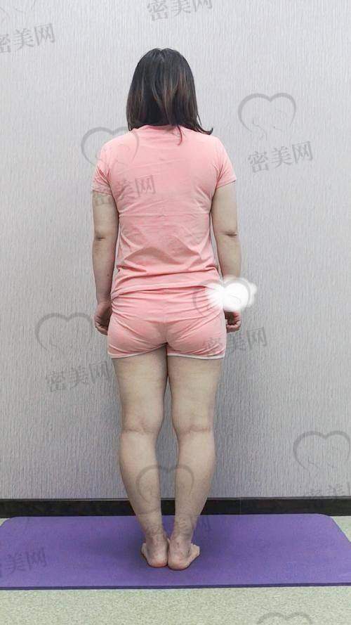 北京联合丽格医疗美容医院（推荐医生：黄绿萍）