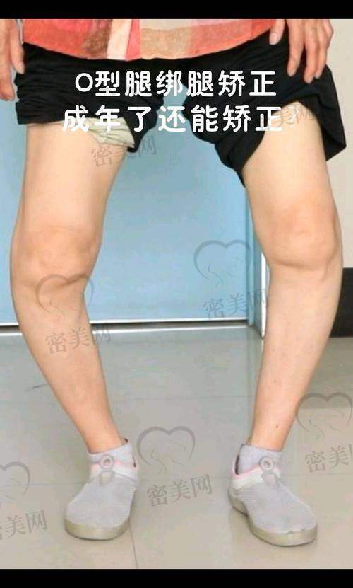 北京知音医疗美容医院（推荐医生：张旭光）
