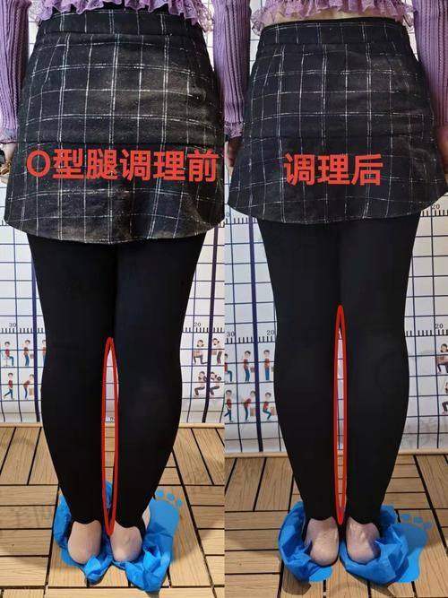 北京雅靓医疗美容机构（推荐医生：李晓东）