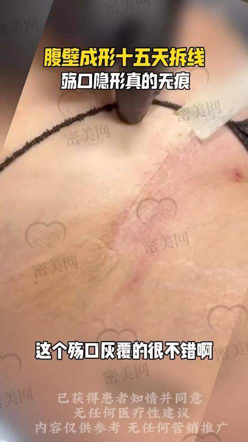 见到西安刘宾医生的初印象