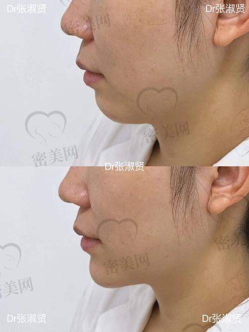 成效不理想