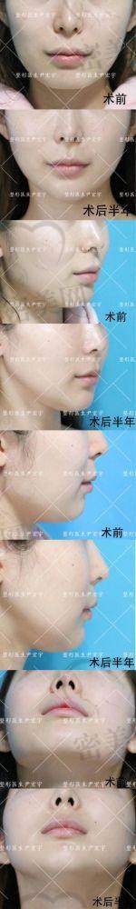年轻人群（20 - 30岁）