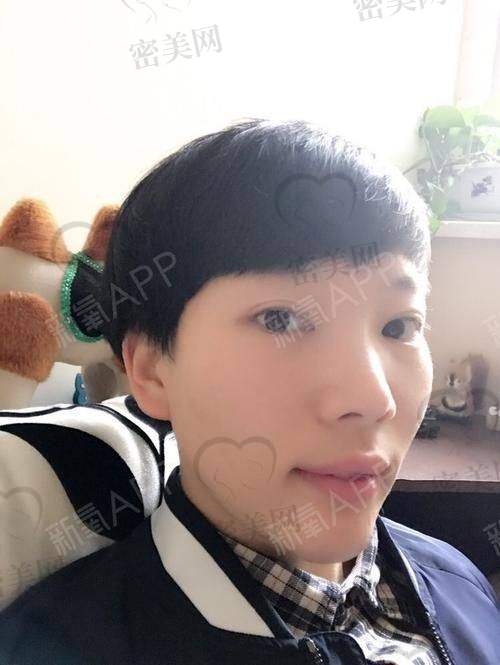 老年人群（50岁以上）