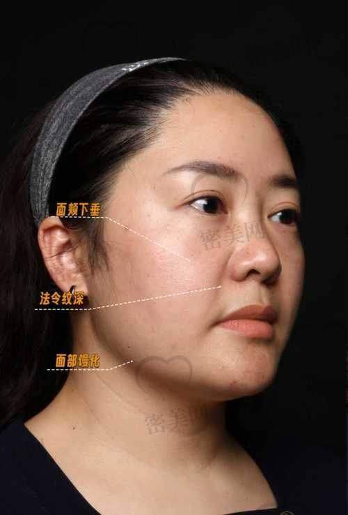 初遇鲁树荣医生：专精与亲和并存