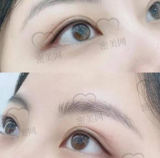 大连雅婷医疗美容口碑如何?患者评价真实吗?